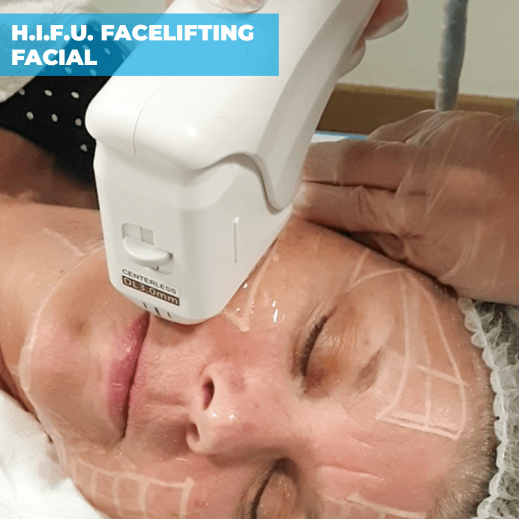 Woman receiving HIFU facelifting facial with ultrasound device at Costa Med Osteopaths
