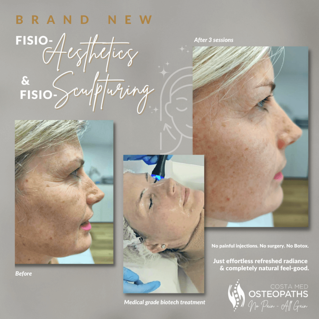 Before-and-after comparison of a woman’s skin following 3 sessions of radiofrequency facials