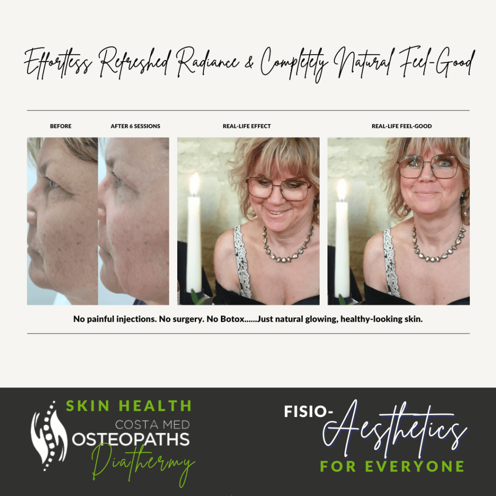 Before-and-after image showing a middle-aged woman’s skin transformation
