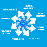 Diagram of TECAR+IONS Resonance Therapy targeting pain in muscles, joints, tendons and bones